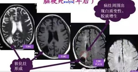 新乡信用卡逾期停息分期还款全攻略