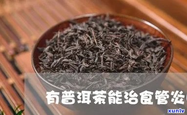 普洱茶对食管炎患者的影响：好处、注意事项与替代品推荐