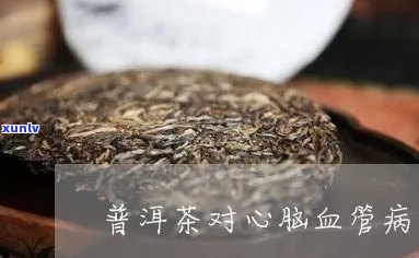 普洱茶的健益处：对心血管系统的影响与研究