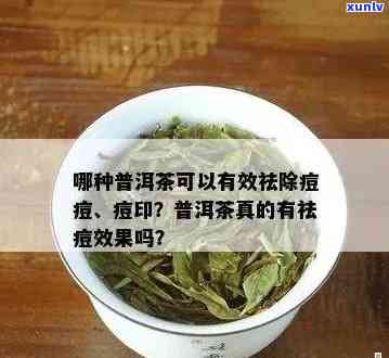 单纯性疱疹喝普洱茶