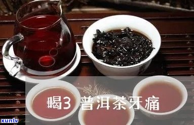 喝普洱茶导致牙痛的全面解决方案和缓解 *** 