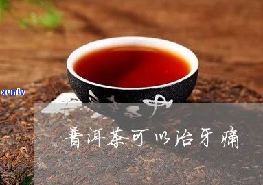 喝普洱茶后牙痛怎么办？的治疗 *** 是什么？