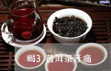 喝普洱茶牙痛怎么治