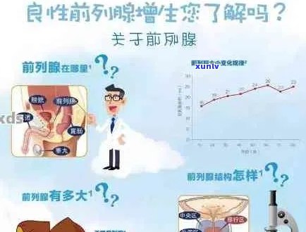 普洱茶对前列腺炎的治疗效果及其综合预防措：研究与实践