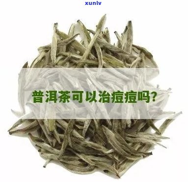 痘痘肌能喝普洱茶吗