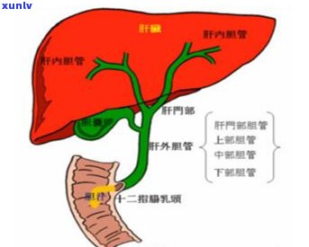 尿有点像红茶是什么原因