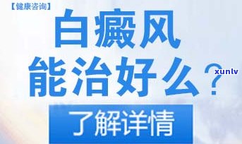 逾期个性化分期条款怎么操作-逾期个性化分期条款怎么操作的