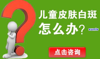 个性化分期会影响信用吗个人报告-个性化分期会影响信用吗个人报告