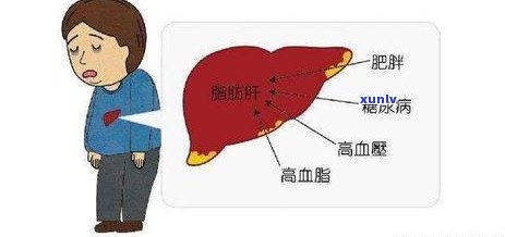 普洱熟茶泡饮搭配指南：如何与各类食材完美融合